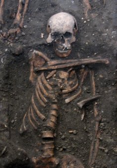 Herpest põdenud täiskasvanud Cambridge'i mehe skelett 14. sajandist